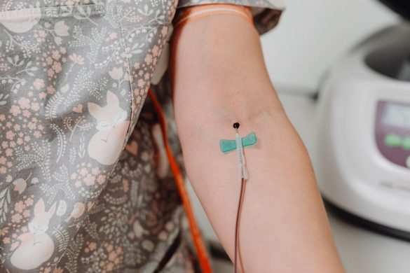 venous insufficiency